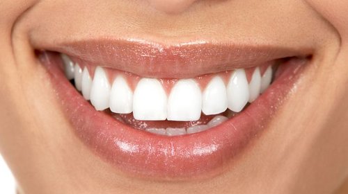 Установка виниров на зубы в стоматологии