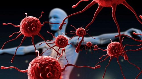 Что такое вторичный иммунодефицит