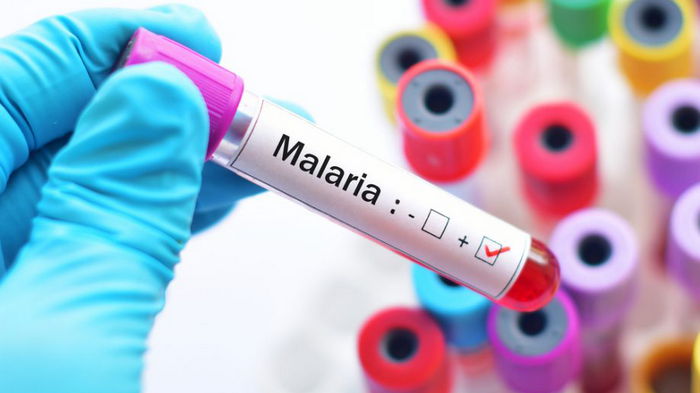 У жительницы Ровенской области обнаружили малярию