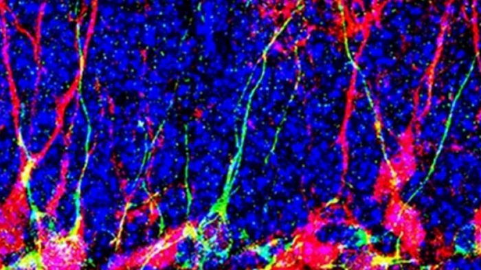 Прорыв в нейробиологии. Ученые научились генерировать новые нейроны в мозге