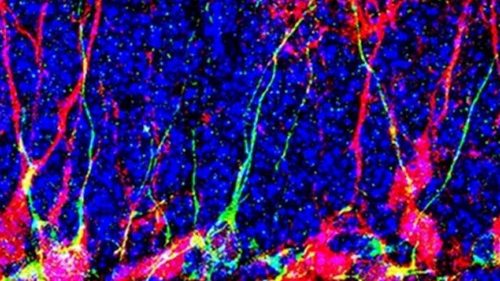 Прорыв в нейробиологии. Ученые научились генерировать новые нейроны в ...