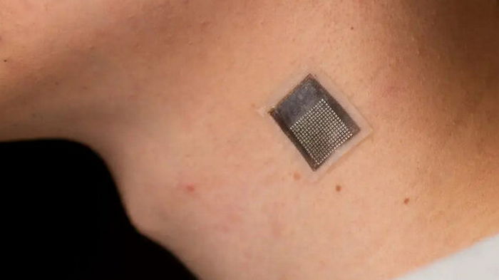 Ученые создали наклейку, которая может делать осмотр под кожей. Это поможет в лечении рака