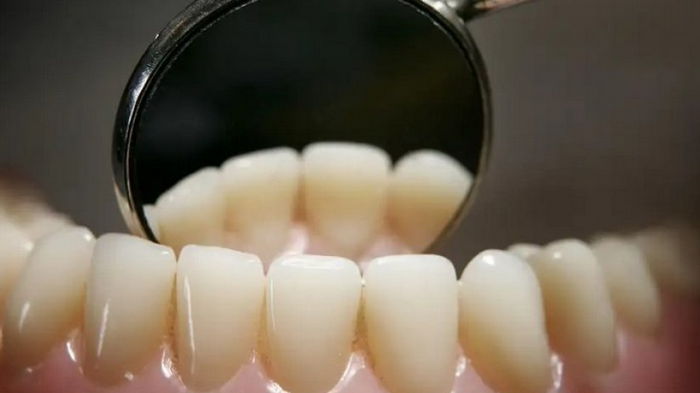 Пренебрежительное отношение к чистке зубов уменьшает мозг