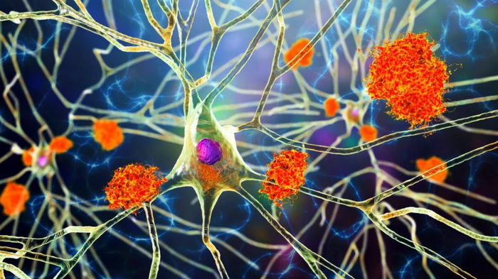 Новое исследование перевернуло наши знания о болезни Альцгеймера