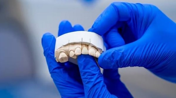 Новые технологии в протезировании зубов