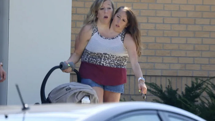 Сиамские близнецы Эбби и Бриттани впервые стали мамами — СМИ