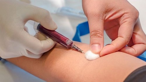 Анализ крови: эффективные методы диагностики организма